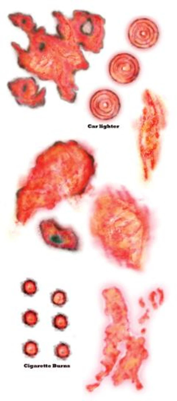 Burned Alive Trauma Tattoo FX | Tinsley | Temporary Tattoos 1 Burned Alive Trauma Tattoo FX | Tinsley | Temporary Tattoos