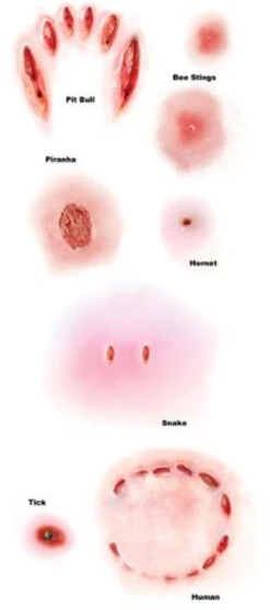 Animal Attack Trauma Tattoo FX | Tinsley | Temporary Tattoos