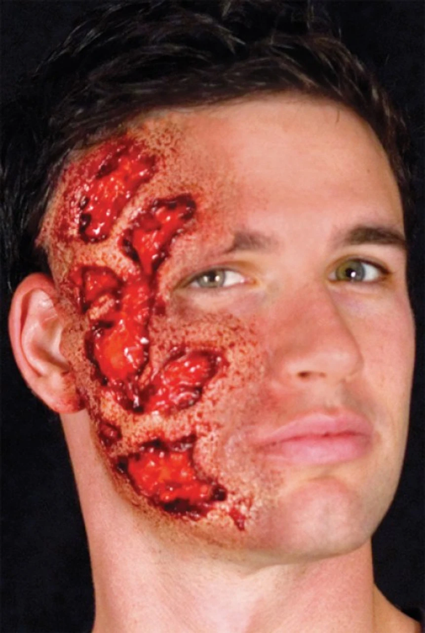 3D Burn Latex Appliance | Woochie | Applications And Prosthetics 1 3D Burn Latex Appliance | Woochie | Applications And Prosthetics