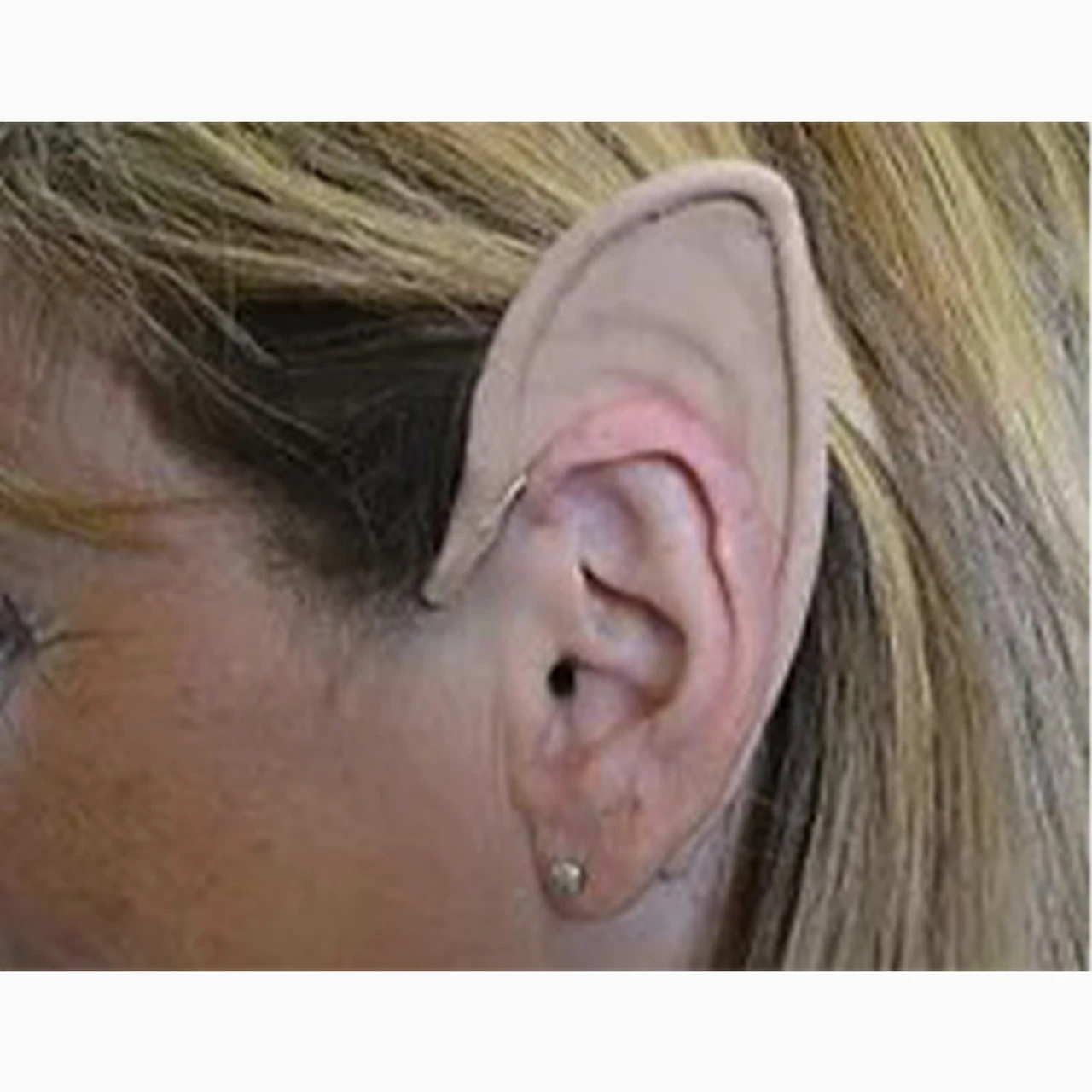 Elf Flexi Ears | Prosthetics | Applications And Prosthetics 1 Elf Flexi Ears | Prosthetics | Applications And Prosthetics