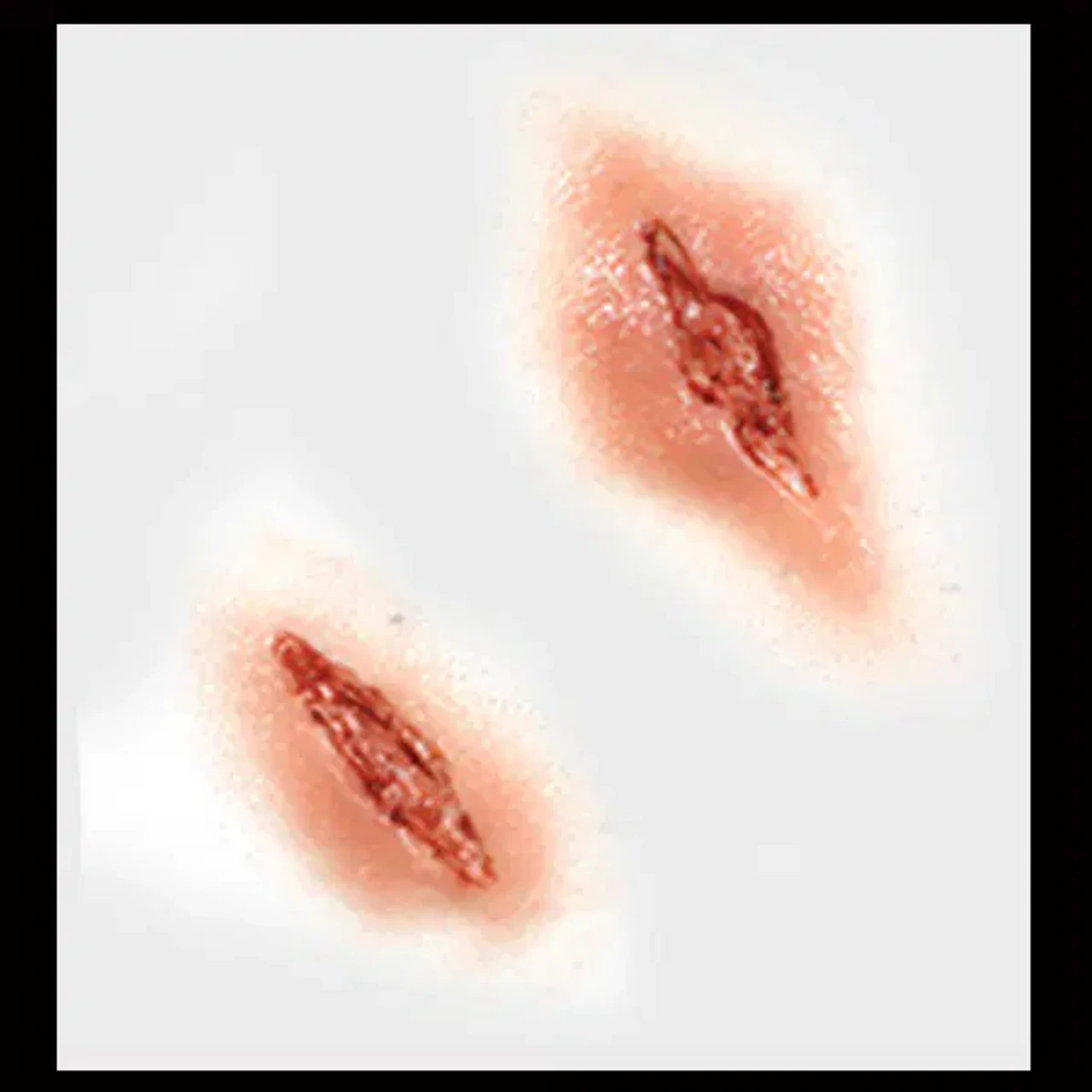 Shanked Knife Wounds 3D Water Applied FX Transfer | Tinsley | Applications And Prosthetics 2 Shanked Knife Wounds 3D Water Applied FX Transfer | Tinsley | Applications And Prosthetics - Image 2